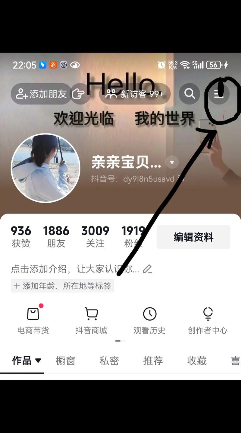 抖音刷粉咨询dajiou